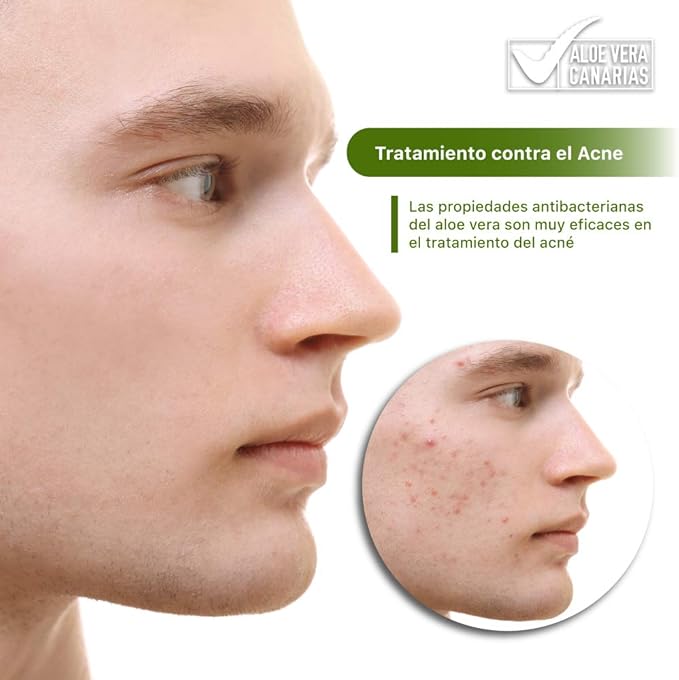 Lote de masajeador facial DKF-408 y Gel Aloe Vera Pure 100% Canario Drakefor