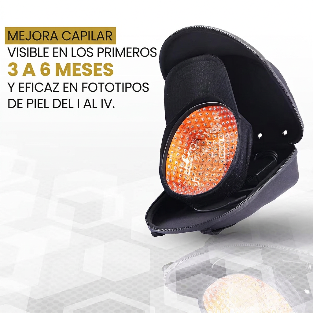 Plazos y fototipos, en español